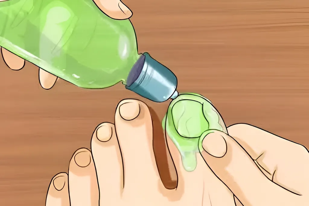 Nail Fungus Treatment